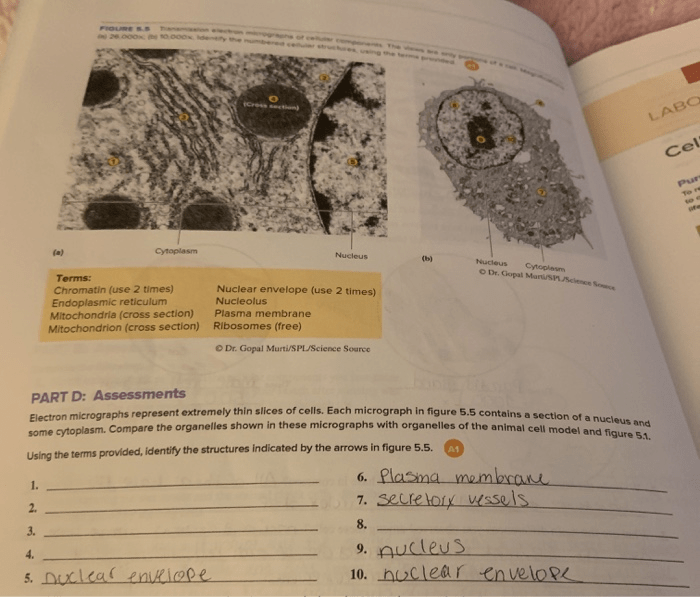 Electron micrographs represent extremely thin slices