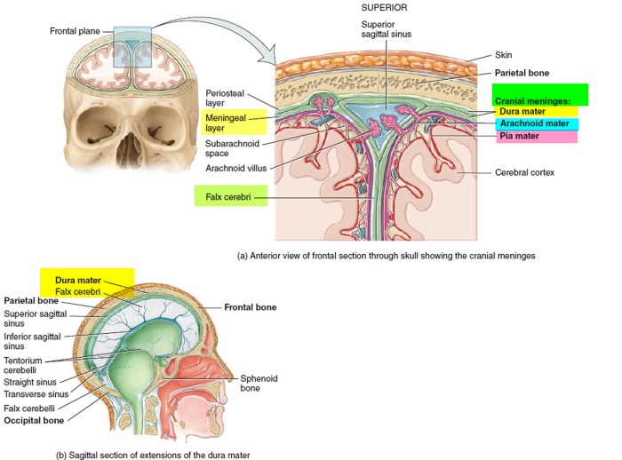 Neoplasms meningioma